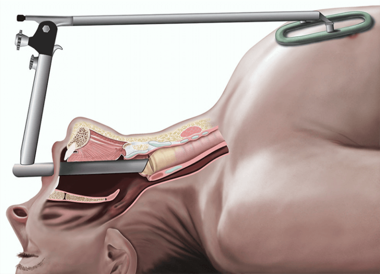 Outpatient Rehabilitation